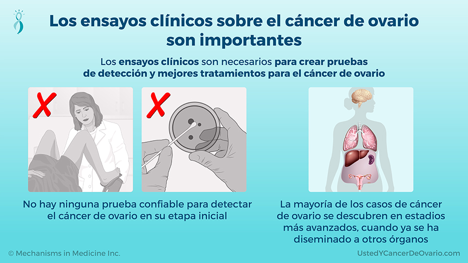 Los ensayos clínicos sobre el cáncer de ovario son importantes