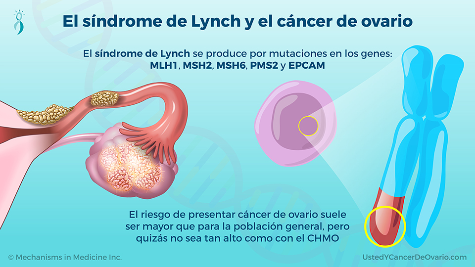 El síndrome de Lynch y el cáncer de ovario