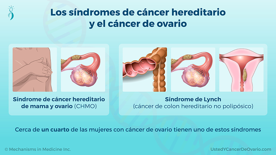 Los síndromes de cáncer hereditario y el cáncer de ovario